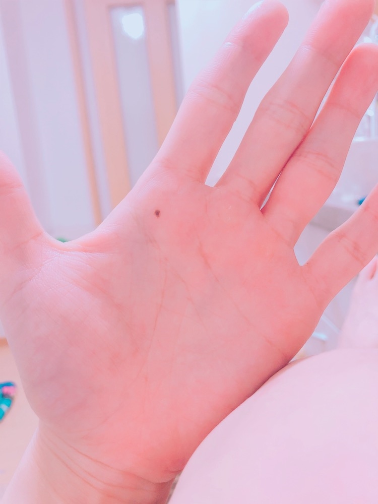 手のひらのホクロ 笑 あやめ 桑名 キャバクラ マリア ポケパラ