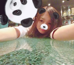 ほなみ「寝てる間に右目ぶつけた？w」