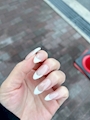 新着ブログ 知らない間のストレスは歯まで割る。