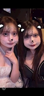 chiko
