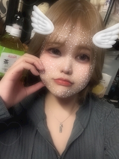 ゆの「小学生ぶりにコケてしまった……🥲🥲」