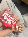 chiko