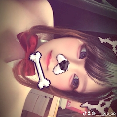 ザクロ「( *・ω・)ノ」