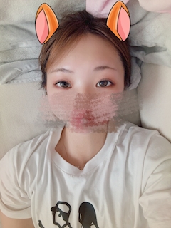 みゆ