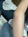 chiko
