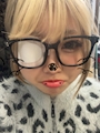 新着ブログ ものもらい😿