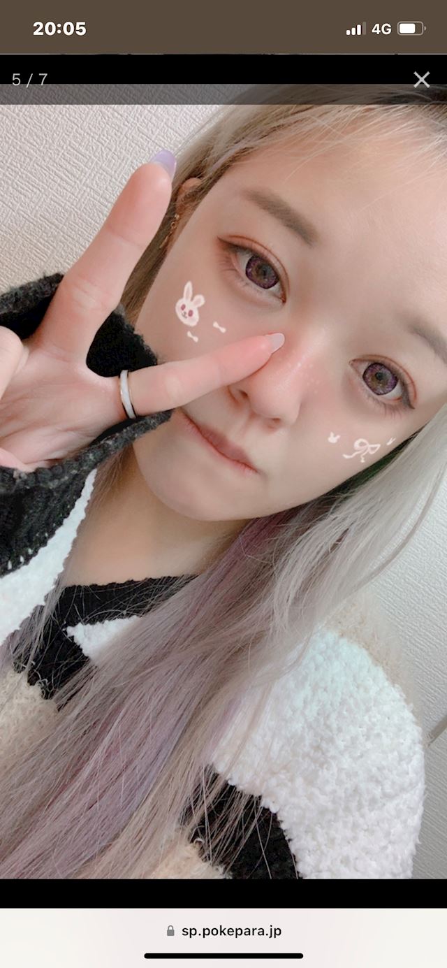 体験談画像