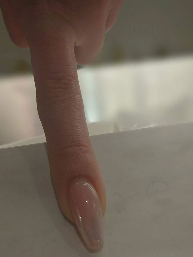 体験談画像
