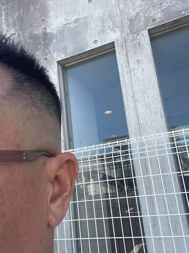 体験談画像