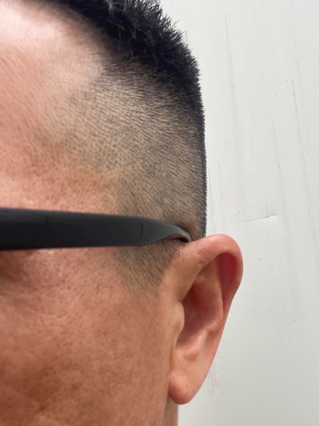 体験談画像