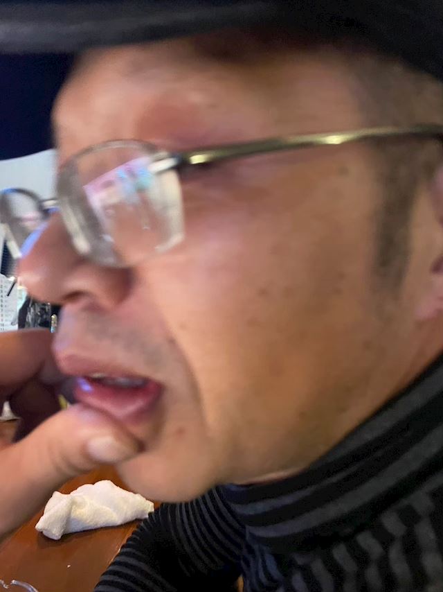 体験談画像