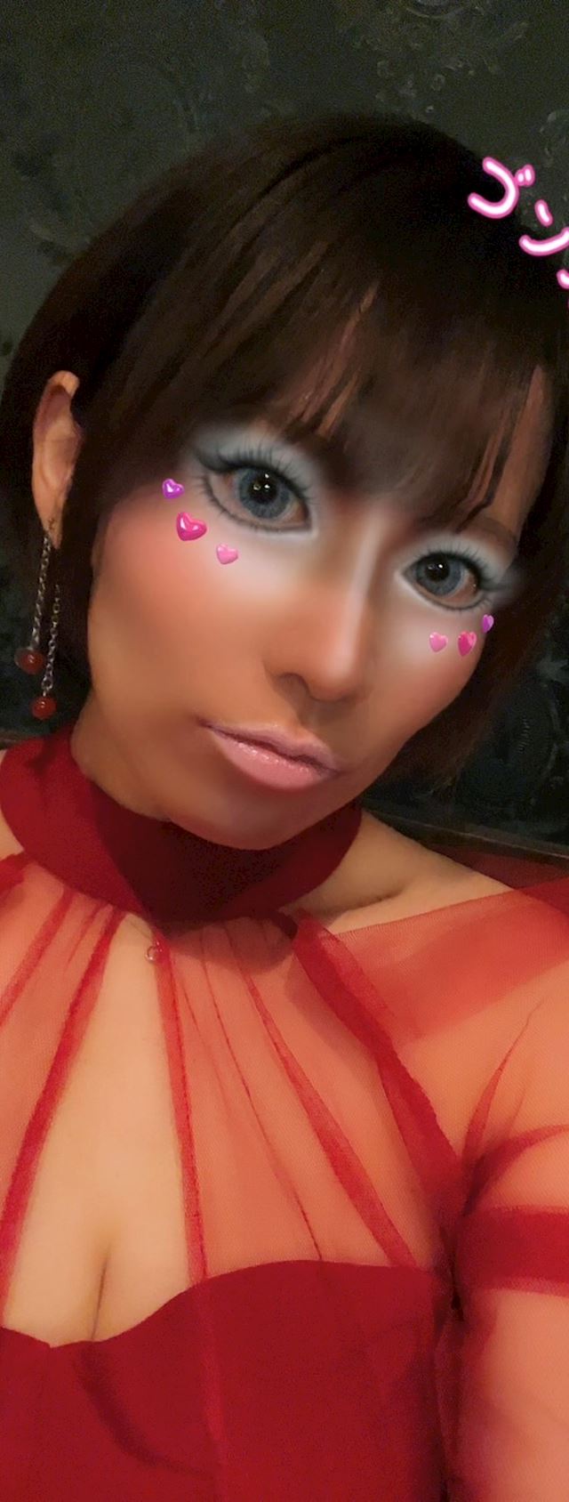 体験談画像