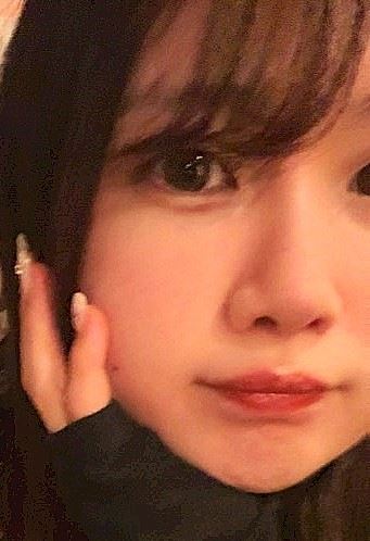 体験談画像